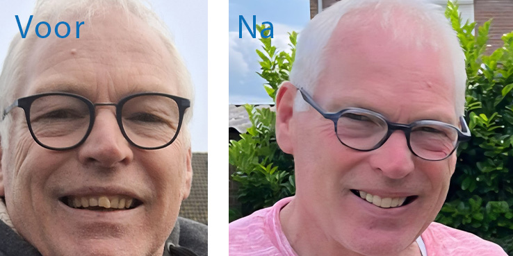 Ik kan weer vertrouwen op sterke tanden - Ervaringen - Tandarts Melis Nieuwe tandartspraktijk in Brakel - Actueel - Tandarts Melis